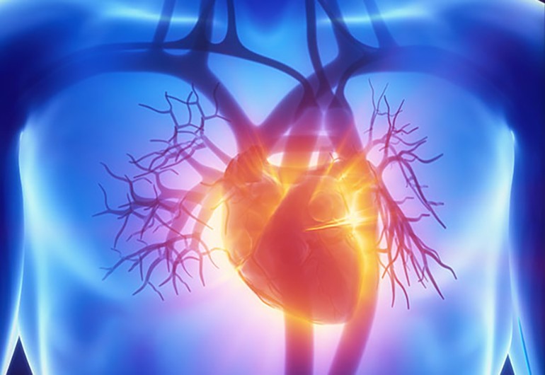Hypertrophic cardiomyopathy