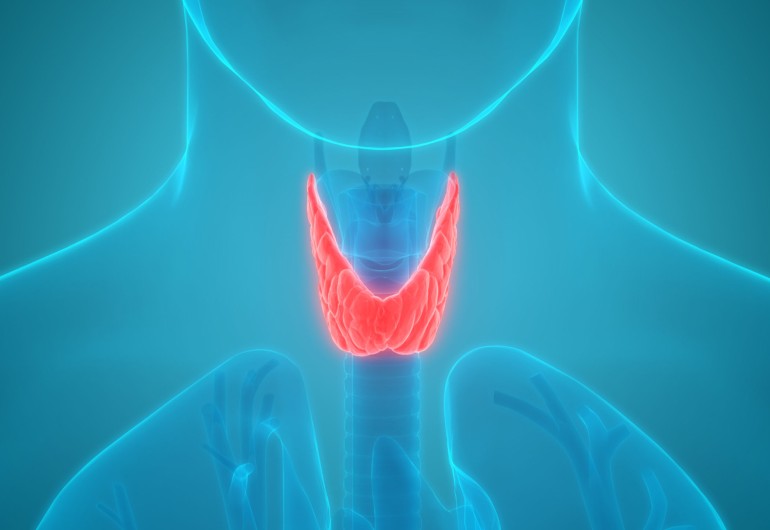 Hyperthyroidism 