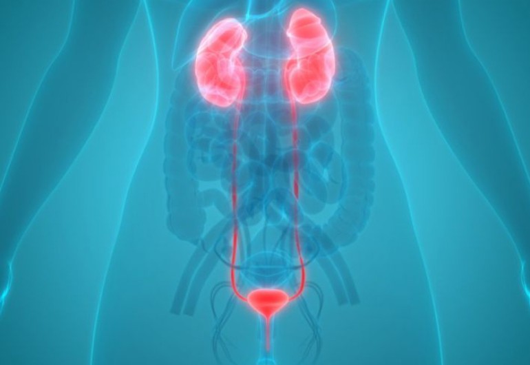 Urinary tract infection (UTI)