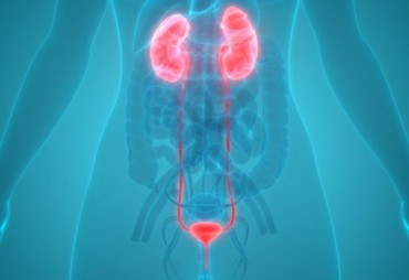 Urinary tract infection (UTI)